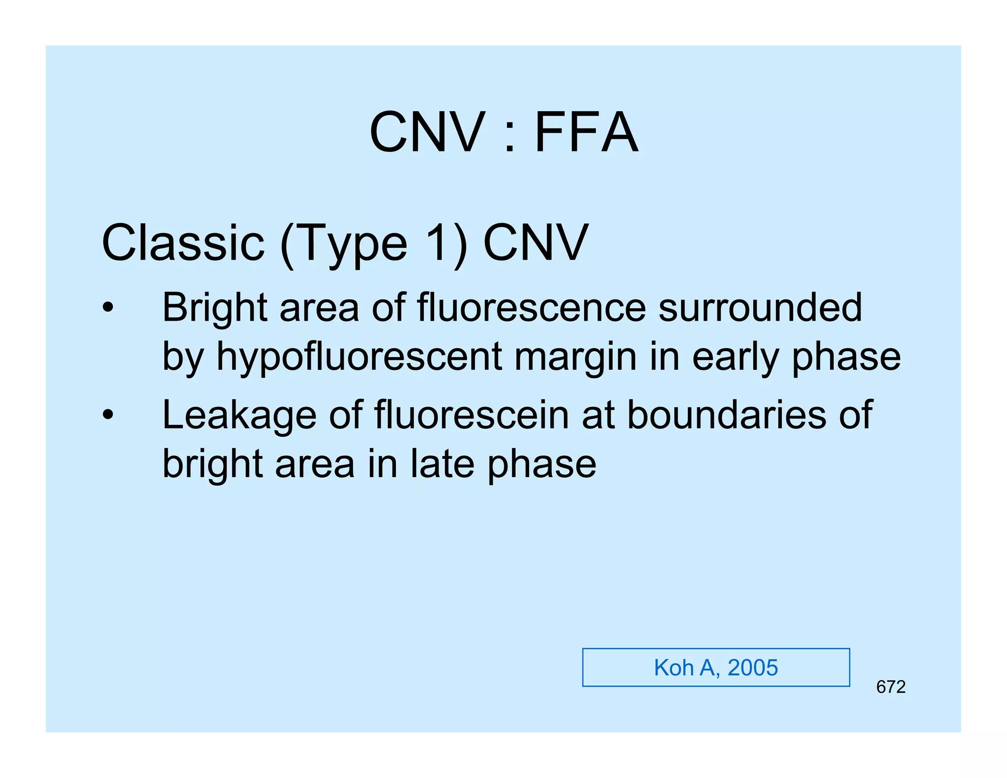 CNV : FFA
Classic (Type 1) CNV
•
•

Bright area of fluorescence surrounded
by hypofluorescent margin in early phase
Leakage of fluorescein at boundaries of
bright area in late phase

Koh A, 2005

672

 