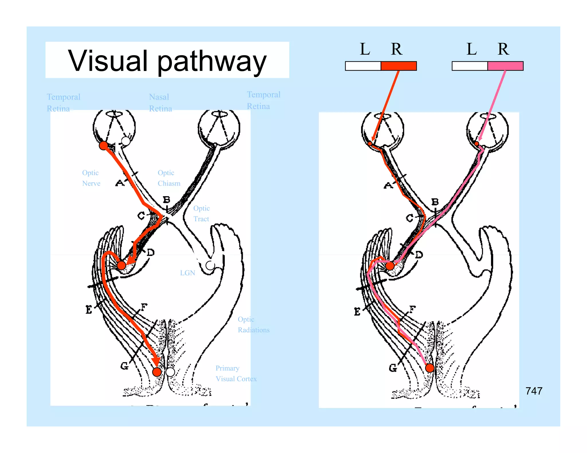 Visual pathway
Temporal
Retina

R

L

R

Temporal
Retina

Nasal
Retina

Optic
Nerve

L

Optic
Chiasm
Optic
Tract

LGN

Optic
Radiations

Primary
Visual Cortex

747

 