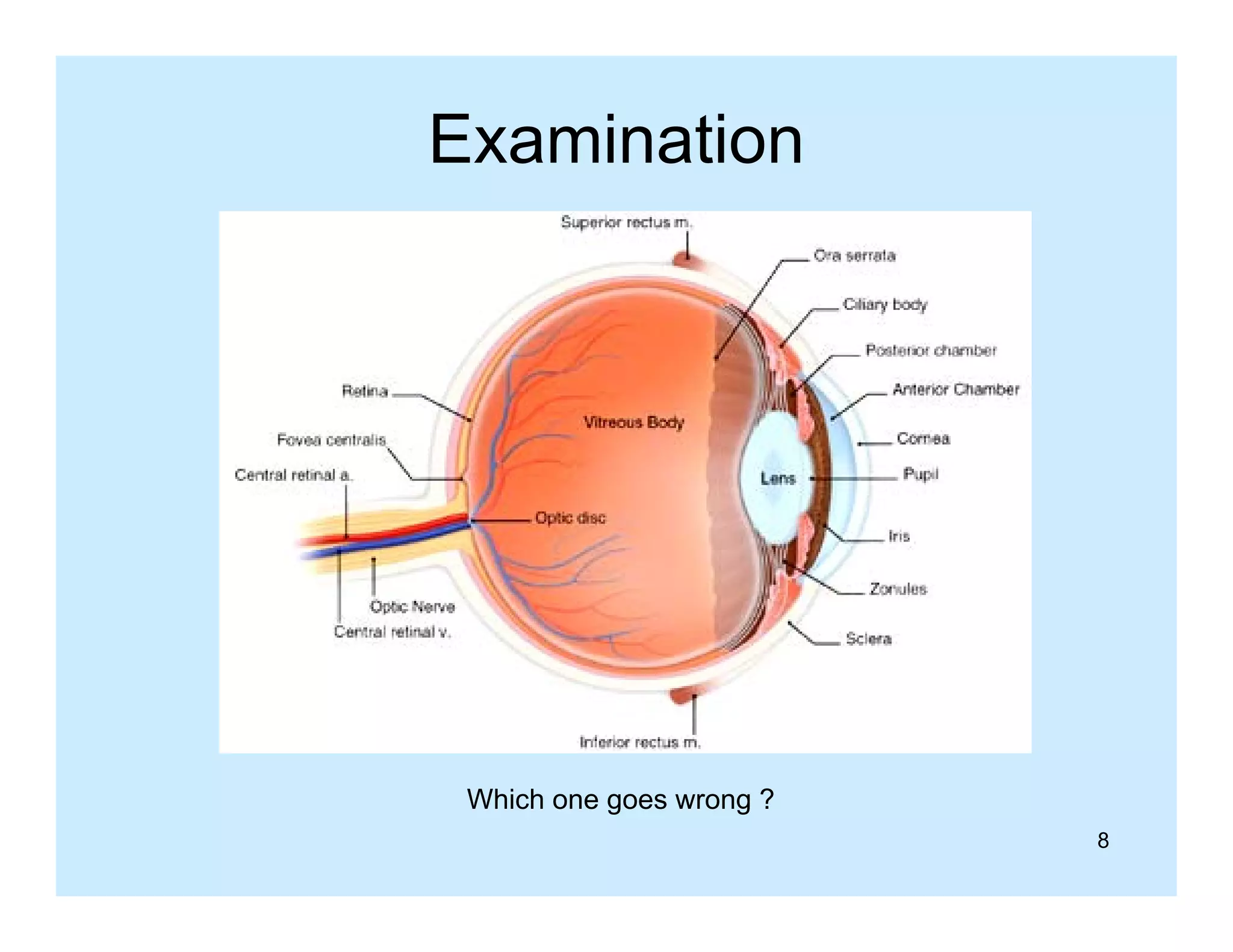 Examination

Which one goes wrong ?
8

 