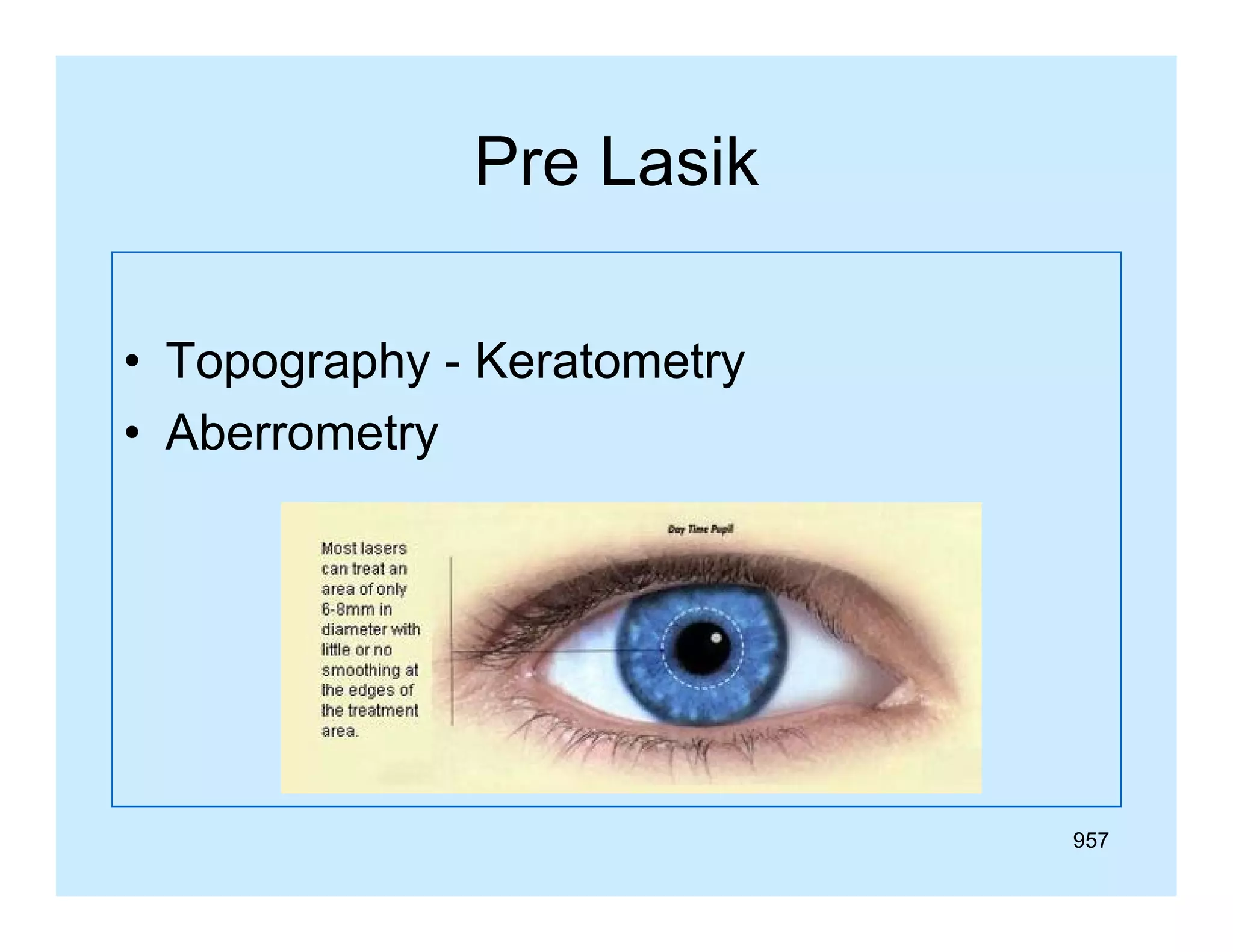 Pre Lasik
• Topography - Keratometry
• Ab
Aberrometry
t

957

 