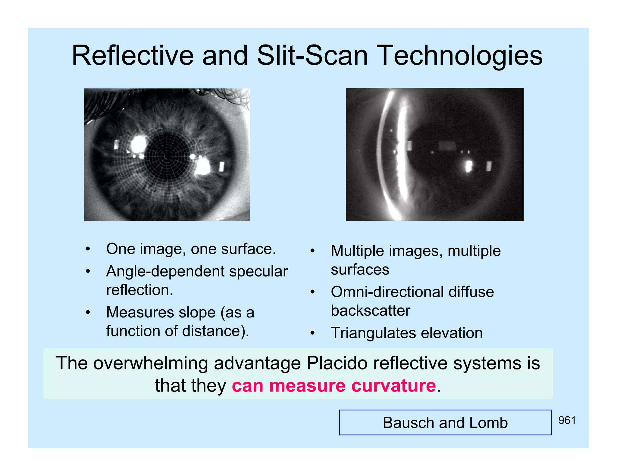 Reflective and Slit-Scan Technologies

•
•
•

One image, one surface.
Angle-dependent specular
A l d
d t
l
reflection.
Measures slope (as a
function of distance).
f
ti
f di t
)

•
•
•

Multiple images, multiple
surfaces
Omni-directional diffuse
backscatter
Triangulates elevation
Ti
l t
l
ti

The overwhelming advantage Placido reflective systems is
that they can measure curvature
curvature.
Bausch and Lomb

961

 