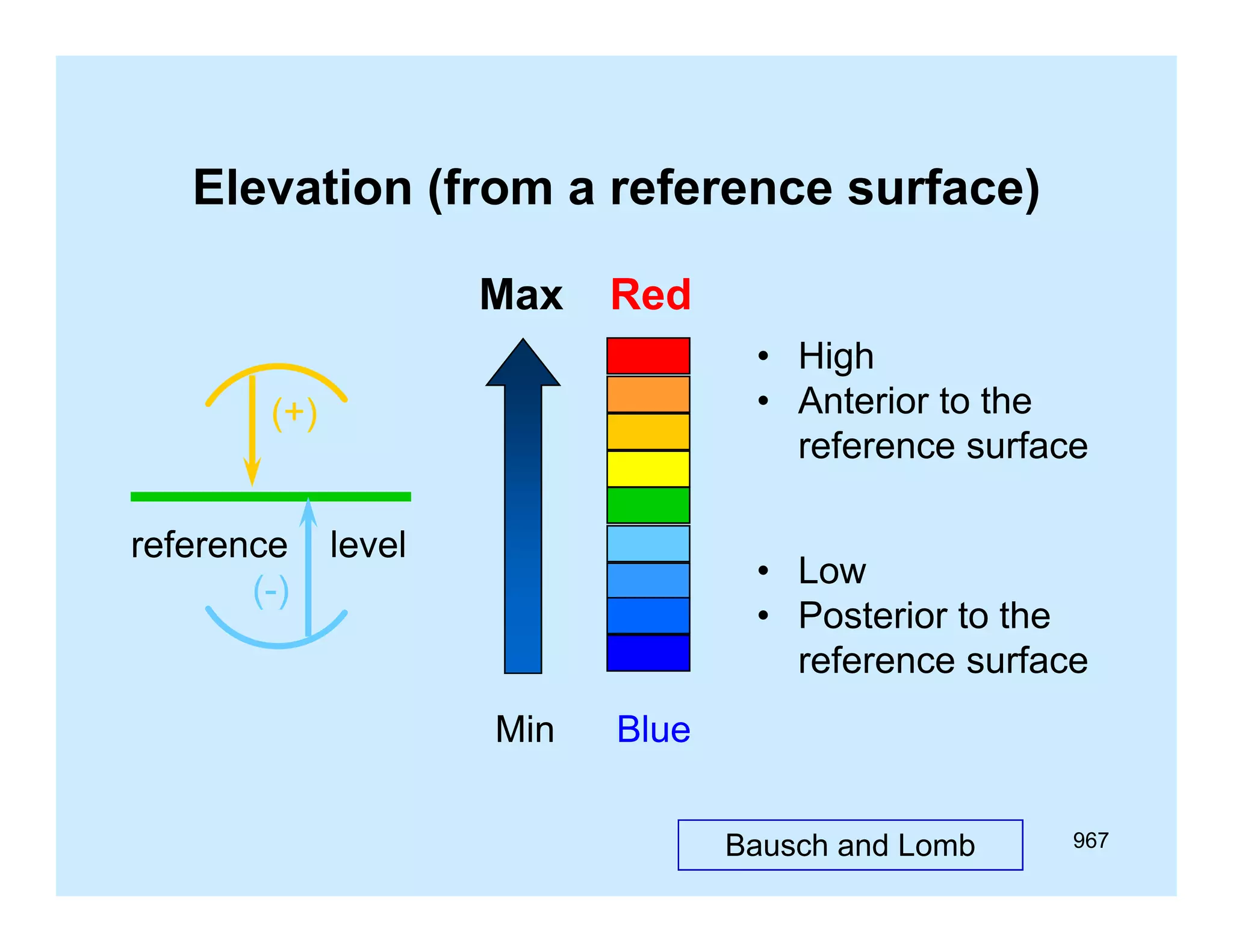 Elevation (f
El
ti (from a reference surface)
f
f
)
Max

Red
• High
• Anterior to the
reference surface

(+)
reference
f
(-)

level
l
l

• Low
• Posterior to the
reference surface
Min

Blue
Bausch and Lomb

967

 