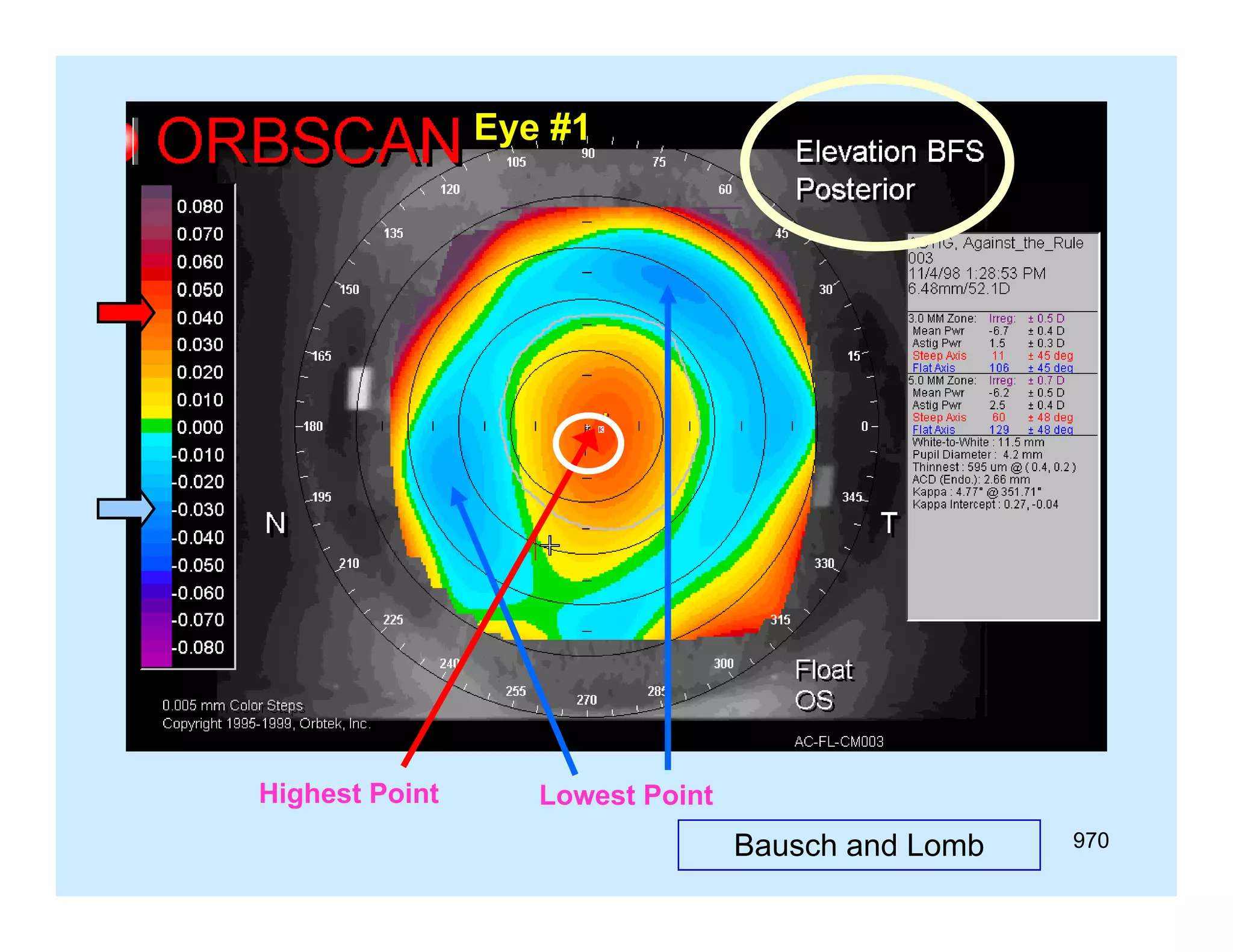 Eye #1

Highest Point

Lowest Point

Bausch and Lomb

970

 