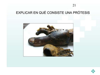21

EXPLICAR EN QUÉ CONSISTE UNA PRÓTESIS
 