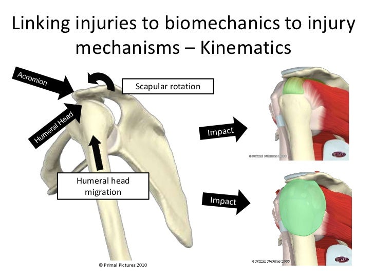 Matching Shoulder Job Demands To Functional Capacity