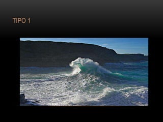 TIPO 1
 