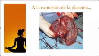 A la expulsión de la placenta…
 