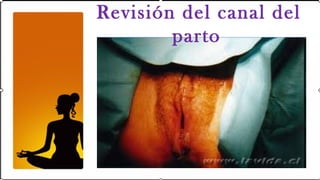 Revisión del canal del
        parto
 