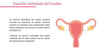La tracción controlada del cordón umbilical
consiste en traccionar el cordón umbilical
mientras se mantiene una contrapresión hacia
arriba colocando una mano en la parte inferior
del abdomen.
Además, la tracción controlada del cordón
umbilical sólo se debe realizar tras los signos
de separación de la placenta.
Tracción controlada del Cordón
 