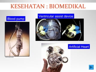 KESEHATAN : BIOMEDIKAL
Blood pump
Ventricular assist device
Artificial Heart
 
