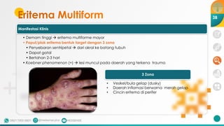 [Materi] - Dermatovenerologi 2 - dr. Ayumi.pdf