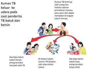 Kuman TB
keluar ke
udara pada
saat penderita
TB batuk dan
bersin
Kuman TB terhirup
oleh orang lain
melalui saluran
pernafasan menuju
paru-paru dan dapat
menyebar ke bagian
tubuh lainnya.
Jika daya tahan
tubuh kuat,
orang tersebut
tetap sehat.
Di dalam tubuh,
kuman TB dilawan
oleh daya tahan
tubuh.
Jika daya tahan
tubuh lemah,
orang tersebut
menjadi sakit TB
 