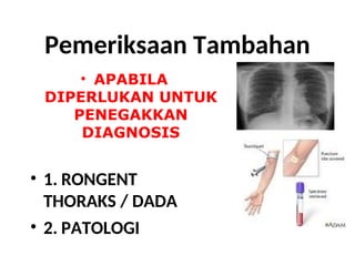 materi-penyuluhan-tbc-presnetasippt-.ppt
