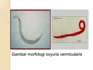 Gambar morfologi oxyuris vermicularis
 