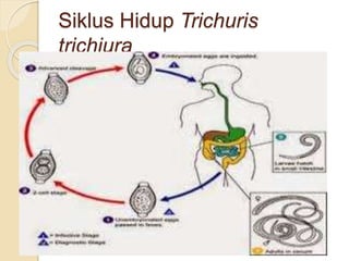 Siklus Hidup Trichuris
trichiura
 