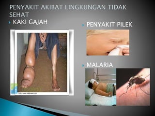  KAKI GAJAH  PENYAKIT PILEK
 MALARIA
 