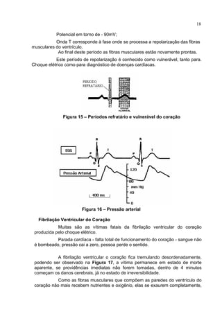18
Potencial em torno de - 90mV;
Onda T corresponde à fase onde se processa a repolarização das fibras
musculares do ventrículo.
Ao final deste período as fibras musculares estão novamente prontas.
Este período de repolarização é conhecido como vulnerável, tanto para.
Choque elétrico como para diagnóstico de doenças cardíacas.
Figura 15 – Períodos refratário e vulnerável do coração
Figura 16 – Pressão arterial
Fibrilação Ventricular do Coração
Muitas são as vítimas fatais da fibrilação ventricular do coração
produzida pelo choque elétrico.
Parada cardíaca - falta total de funcionamento do coração - sangue não
é bombeado, pressão cai a zero, pessoa perde o sentido.
A fibrilação ventricular o coração fica tremulando desordenadamente,
podendo ser observado na Figura 17, a vítima permanece em estado de morte
aparente, se providências imediatas não forem tomadas, dentro de 4 minutos
começam os danos cerebrais, já no estado de irreversibilidade.
Como as fibras musculares que compõem as paredes do ventrículo do
coração não mais recebem nutrientes e oxigênio, elas se exaurem completamente,
 