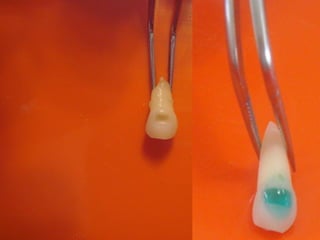Materiais dentários em odontopediatria