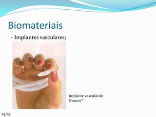 Biomateriais
        - Implantes vasculares;




                                  Implante vascular de
                                  DraconTM


25/52
 
