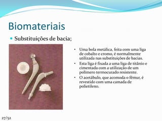 Biomateriais
     Substituições de bacia;
                                • Uma bola metálica, feita com uma liga
                                  de cobalto e cromo, é normalmente
                                  utilizada nas substituições de bacias.
                                • Esta liga é fixada a uma liga de titânio e
                                  cimentada com a utilização de um
                                  polímero termocurado resistente.
                                • O acetábulo, que acomoda o fêmur, é
                                  revestido com uma camada de
                                  polietileno.




27/52
 