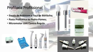 Profilaxia Profissional
• Escola de Robinson e Taça de Borracha;
• Pasta Profilática ou Pedra-Pomes;
• Micromotor com Contra-Ângulo.
 
