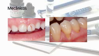 Mecânicos
 