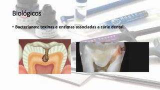 Biológicos
• Bacterianos: toxinas e enzimas associadas a cárie dental.
 