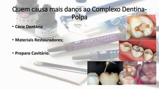 Quem causa mais danos ao Complexo Dentina-
Polpa
• Cárie Dentária
• Materiais Restauradores;
• Preparo Cavitário.
 