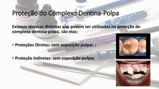 Proteção do Complexo Dentina-Polpa
Existem técnicas distintas que podem ser utilizadas na proteção do
complexo dentina-polpa, são elas:
• Proteções Diretas: com exposição pulpar, ;
• Proteção Indiretas: sem exposição pulpar.
 