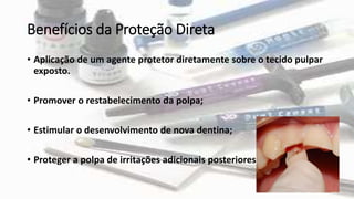 Benefícios da Proteção Direta
• Aplicação de um agente protetor diretamente sobre o tecido pulpar
exposto.
• Promover o restabelecimento da polpa;
• Estimular o desenvolvimento de nova dentina;
• Proteger a polpa de irritações adicionais posteriores.
 