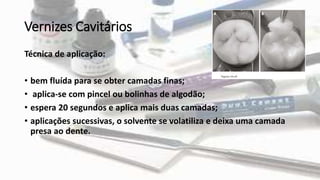 Vernizes Cavitários
Técnica de aplicação:
• bem fluída para se obter camadas finas;
• aplica-se com pincel ou bolinhas de algodão;
• espera 20 segundos e aplica mais duas camadas;
• aplicações sucessivas, o solvente se volatiliza e deixa uma camada
presa ao dente.
 