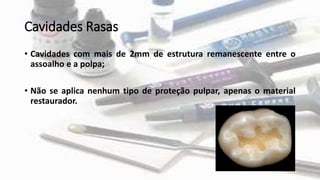Cavidades Rasas
• Cavidades com mais de 2mm de estrutura remanescente entre o
assoalho e a polpa;
• Não se aplica nenhum tipo de proteção pulpar, apenas o material
restaurador.
 