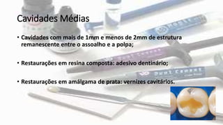 Cavidades Médias
• Cavidades com mais de 1mm e menos de 2mm de estrutura
remanescente entre o assoalho e a polpa;
• Restaurações em resina composta: adesivo dentinário;
• Restaurações em amálgama de prata: vernizes cavitários.
 