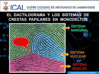 EL DACTILOGRAMA Y LOS SISTEMAS DE
 CRESTAS PAPILARES EN MONODELTOS
                         SISTEMA
                         MARGINAL


   DELTA


                         SISTEMA
                         NUCLEAR

                          SISTEMA
                          BASILAR
                         Félix Roger ESCAJADILLO CABRERA
                           Félix R. ESCAJADILLO CABRERA
 
