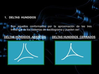 1. DELTAS HUNDIDOS


   Son aquellos conformados por la aproximación de las tres
   limitantes de los sistemas de dactilograma y pueden ser:

DELTAS HUNDIDOS ABIERTOS       DELTAS HUNDIDOS CERRADOS
 