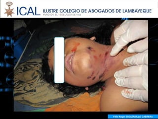 Félix Roger ESCAJADILLO CABRERA
  Félix R. ESCAJADILLO CABRERA
 