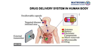 DRUG DELIVERY SYSTEM IN HUMAN BODY
MATRUSRI
ENGINEERING COLLEGE
 