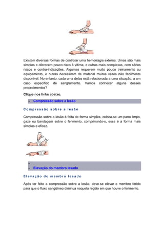 Existem diversas formas de controlar uma hemorragia externa. Umas são mais
simples e oferecem pouco risco à vítima, e outras mais complexas, com sérios
riscos e contra-indicações. Algumas requerem muito pouco treinamento ou
equipamento, e outras necessitam de material muitas vezes não facilmente
disponível. No entanto, cada uma delas está relacionada a uma situação, a um
caso específico de sangramento. Vamos conhecer alguns desses
procedimentos?
Clique nos links abaixo.
• Compressão sobre a lesão
C o m p r e s s ã o s o b r e a l e s ã o
Compressão sobre a lesão é feita de forma simples, coloca-se um pano limpo,
gaze ou bandagem sobre o ferimento, comprimindo-o, essa é a forma mais
simples e eficaz.
•
• Elevação do membro lesado
E l e v a ç ã o d o m e m b r o l e s a d o
Após ter feito a compressão sobre a lesão, deve-se elevar o membro ferido
para que o fluxo sangüíneo diminua naquela região em que houve o ferimento.
 