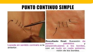 PUNTO CONTINUO SIMPLE
 