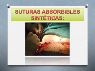 Material de sutura