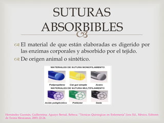 SUTURAS 
ABSORBIBLES 
 
 El material de que están elaboradas es digerido por 
las enzimas corporales y absorbido por el tejido. 
 De origen animal o sintético. 
Hernández Guzmán, Guillermina; Aguayo Bernal, Rebeca; “Técnicas Quirúrgicas en Enfermeria”;1era Ed., México, Editores 
de Textos Mexicanos, 2003; 22-24. 
 