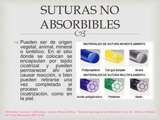 SUTURAS NO 
ABSORBIBLES 
 
 Pueden ser de origen 
vegetal, animal, mineral 
o sintético. En el sitio 
donde se colocan se 
encapsulan por tejido 
cicatrizal y pueden 
permanecer ahí sin 
causar reacción, o bien 
pueden retirarse una 
vez completado el 
proceso de 
cicatrización, como en 
la piel. 
Hernández Guzmán, Guillermina; Aguayo Bernal, Rebeca; “Técnicas Quirúrgicas en Enfermeria”;1era Ed., México, Editores 
de Textos Mexicanos, 2003; 22-24. 
 