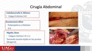 Cirugía Abdominal
Coledocorrafia V. Biliares
• Catgut Crómico 3-0
Anastomosis Biliar
• Polipropileno o Poliéster
3-0
Hígado, Bazo
• Catgut crómico 1-0 o 1
Tomando mucho tejido en los puntos
[desgarro]
 