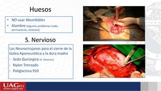 Huesos
• NO usar Absorbibles
• Alambre [algunos problemas nudo,
permanente, molestia]
S. Nervioso
Los Neurocirujanos para el cierre de la
Galea Aponeurótica y la dura madre
• Seda Quirúrgica [R. Adversas]
• Nylon Trenzado
• Poliglactina 910
 