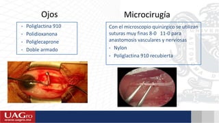 • Poliglactina 910
• Polidioxanona
• Poliglecaprone
• Doble armado
Ojos Microcirugía
Con el microscopio quirúrgico se utilizan
suturas muy finas 8-0 11-0 para
anastomosis vasculares y nerviosas
• Nylon
• Poliglactina 910 recubierta
 