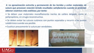 4. La aproximación estrecha y permanente de las heridas y evitar materiales de
sutura que provocan reacción brinda resultados satisfactorios cuando se pretende
obtener cicatrices más estéticas; por tanto:
• Se deben usar materiales monoﬁlamento inertes de calibre delgado, como el
polipropileno, en cirugía reconstructiva.
• Se deben evitar las suturas cutáneas con puntos separados y recurrir a los puntos
subdérmico cuando sea posible.
• Sustituir precozmente la sutura por vendoletes.
 
