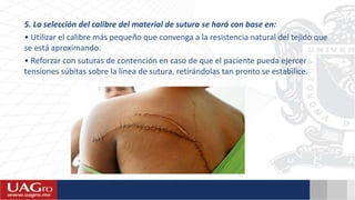 5. La selección del calibre del material de sutura se hará con base en:
• Utilizar el calibre más pequeño que convenga a la resistencia natural del tejido que
se está aproximando.
• Reforzar con suturas de contención en caso de que el paciente pueda ejercer
tensiones súbitas sobre la línea de sutura, retirándolas tan pronto se estabilice.
 