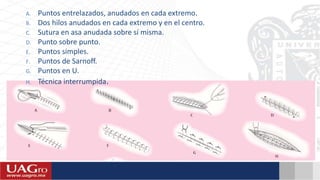 A. Puntos entrelazados, anudados en cada extremo.
B. Dos hilos anudados en cada extremo y en el centro.
C. Sutura en asa anudada sobre sí misma.
D. Punto sobre punto.
E. Puntos simples.
F. Puntos de Sarnoff.
G. Puntos en U.
H. Técnica interrumpida.
 