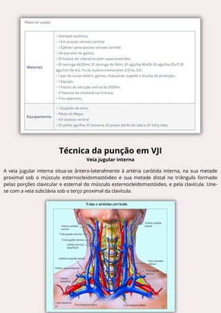 Técnica da punção em VJI
Veia jugular interna
A veia jugular interna situa-se ântero-lateralmente à artéria carótida interna, na sua metade
proximal sob o músculo esternocleidomastóideo e sua metade distal no triângulo formado
pelas porções clavicular e esternal do músculo esternocleidomastóideo, e pela clavícula. Une-
se com a veia subclávia sob o terço proximal da clavícula.
 