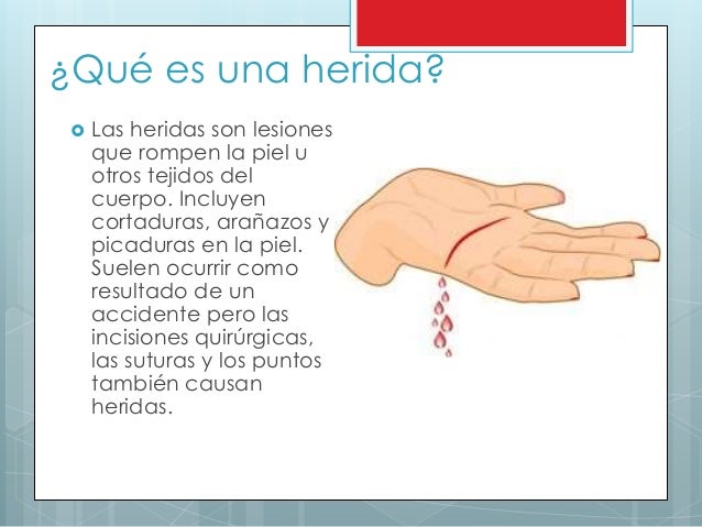 El spray termikon del hongo de las uñas las revocaciones